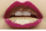 Gloss